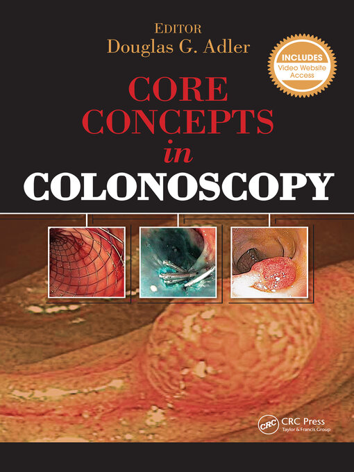Title details for Core Concepts in Colonoscopy by Douglas Adler - Wait list